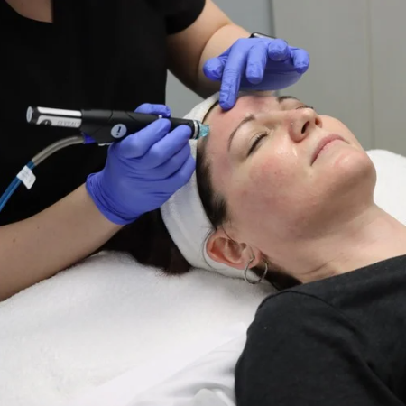 HYDRAFACIAL