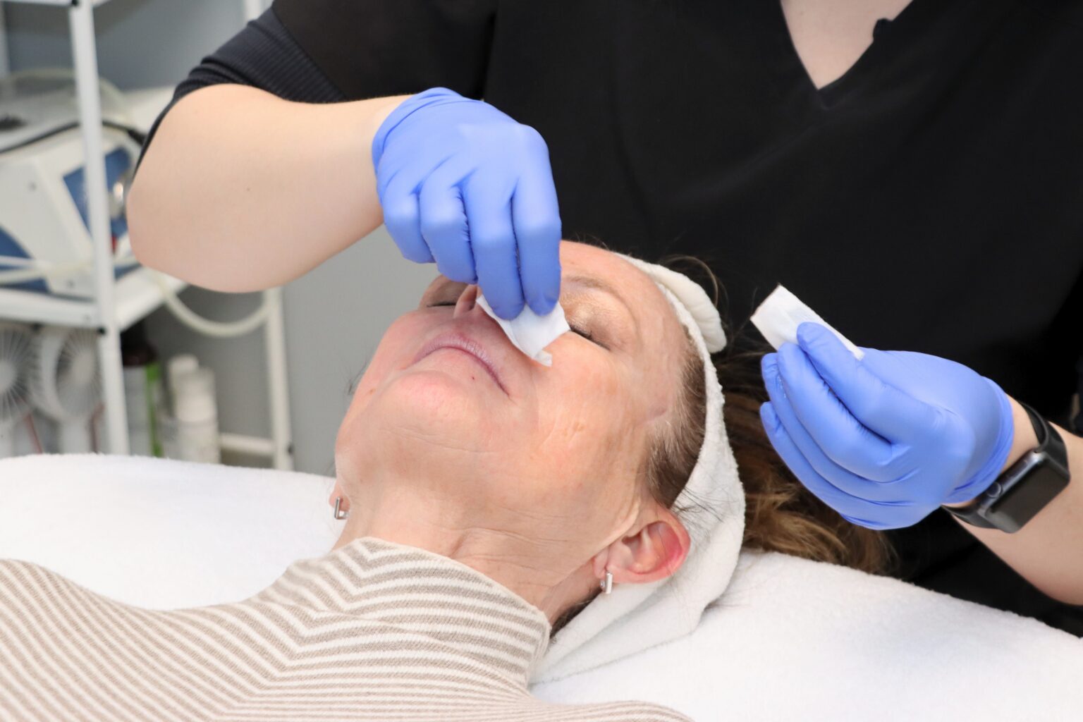 Patient receiving a chemical peel treatment